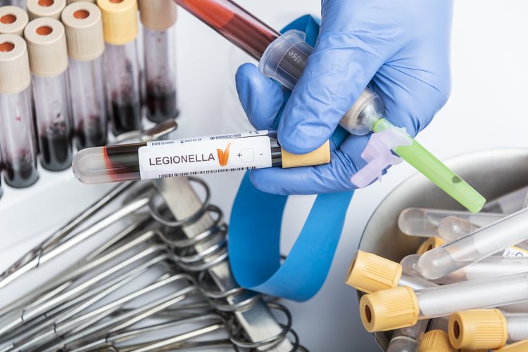 Legionella prevention for client in the UK